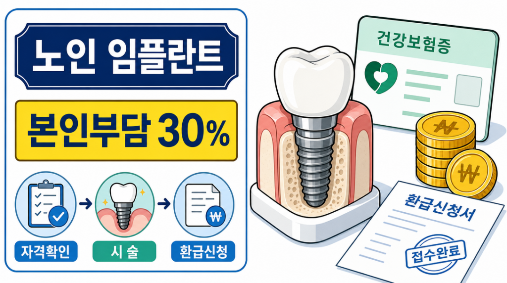 노인 임플란트 본인부담금 환급 신청방법 안내 인포그래픽